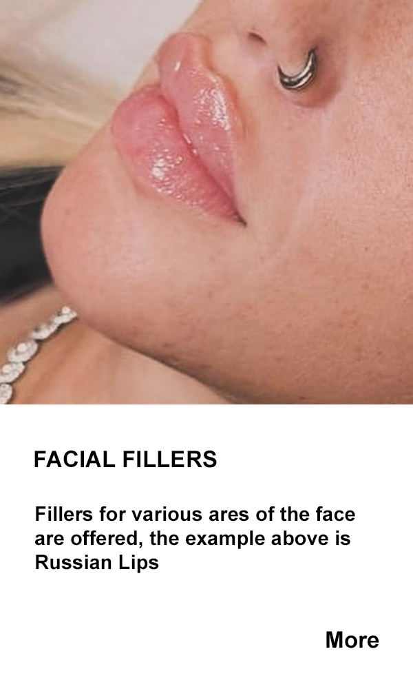 Facial Fillers Aesthetics at Sevenoaks