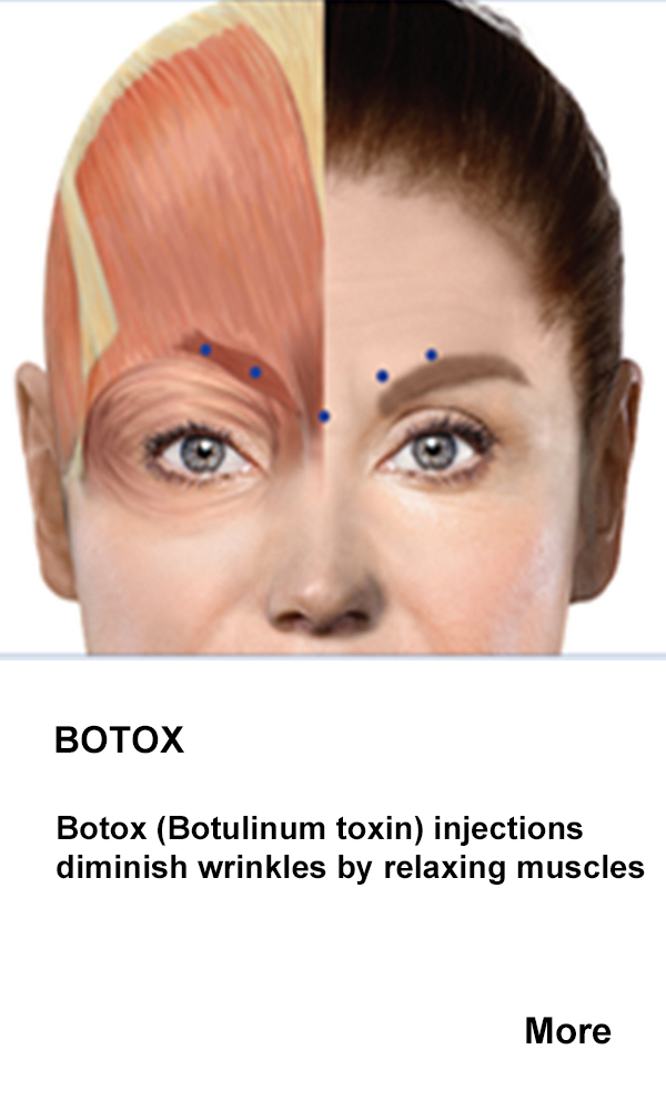 Botox Aesthetics at Sevenoaks